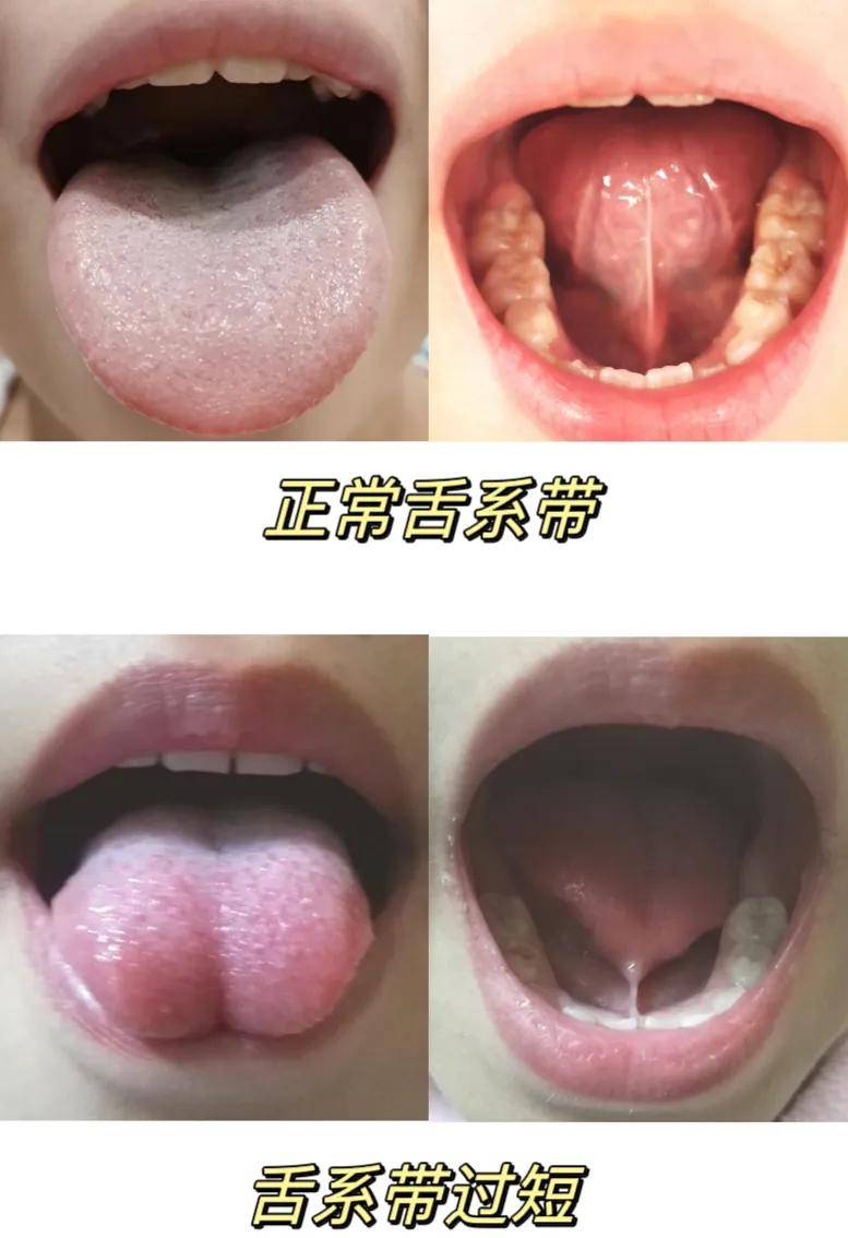 科普展现:舌头打结名字（舌头打结的名字）